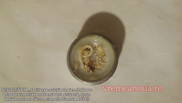 Parazitozele intestinale: giardioza si ascaridioza | soaptele.ro